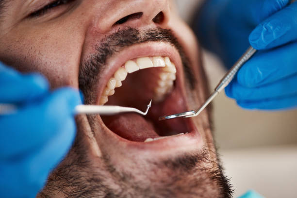 Best Emergency Dental Care for Abscessed Tooth in Granger, TX