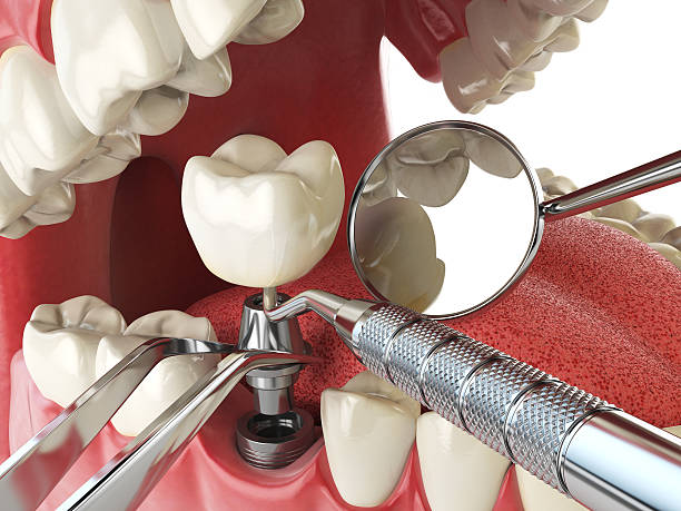 Best Emergency Dental Services for Seniors in Granger, TX